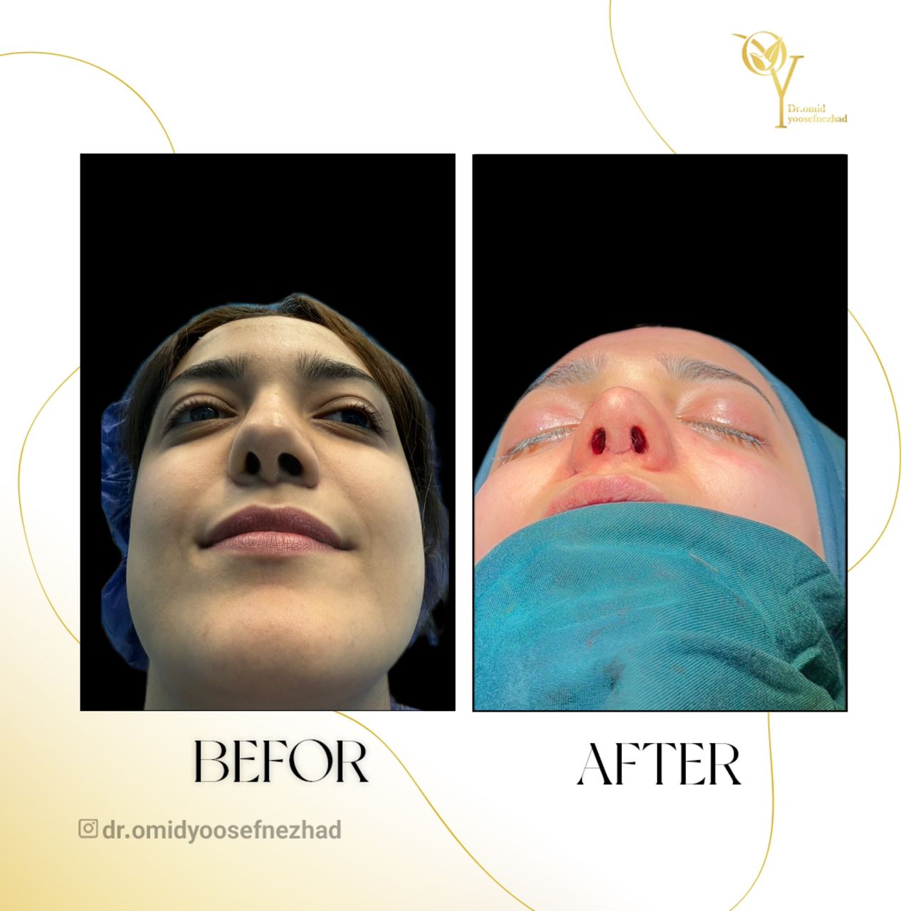 بهترین جراح زیبایی مازندران کیست؟ (معیارهای انتخاب فوق تخصص) دکتر امید یوسف نژاد