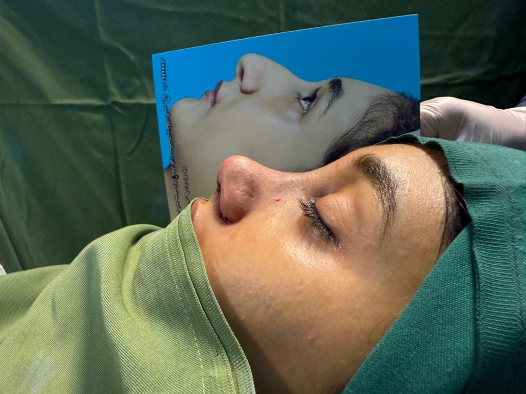 جراحی زیبایی بینی در مازندران